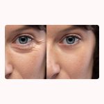 BIONIC TECH® EverGlow Fiatalító Szemápoló Szérum és Szemkörnyék Ápoló Emelő (Lifter) AJÁNDÉK TERMÉKEKKEL