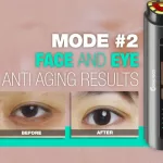 RF Pro Facelifter -  rádófrekvenciás anti-aging arckezelő 